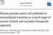 Human prostate cancer cell epithelial-to-mesenchymal transition as a novel target of arsenic trioxide and curcumin therapeutic approach